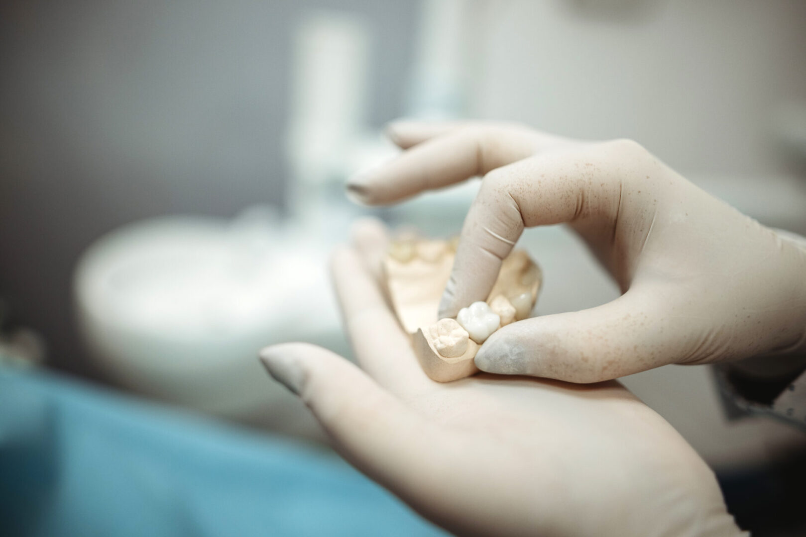Dental professional with tooth impression