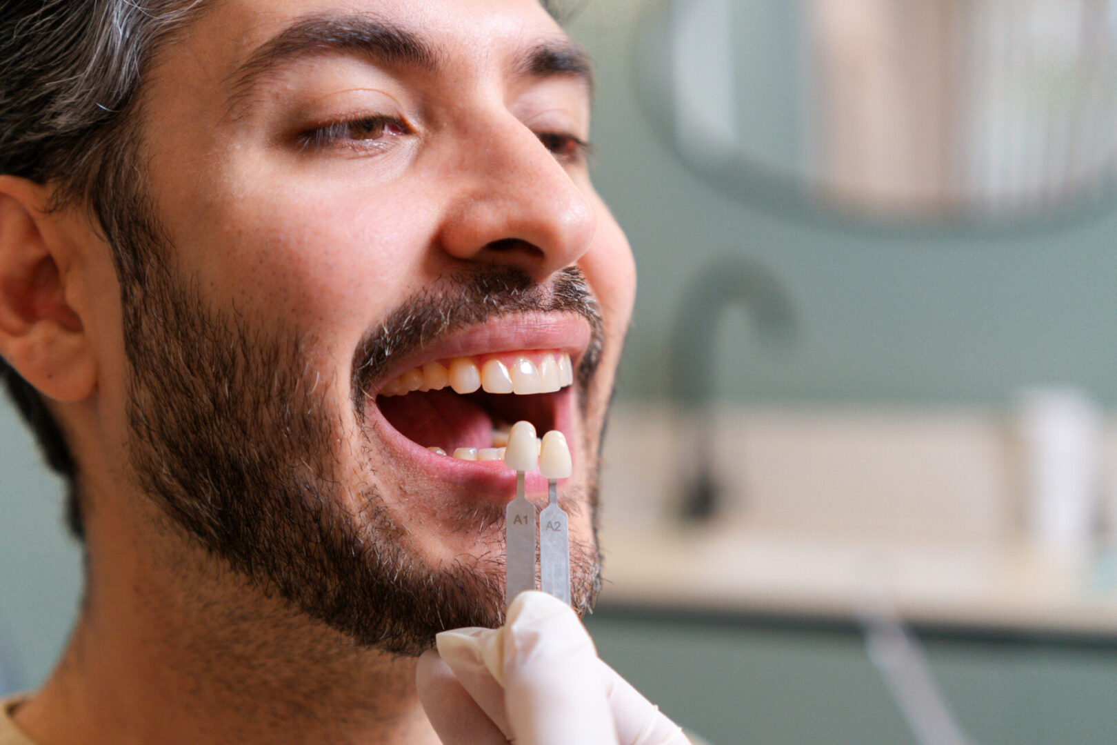 Dentist comparing tooth shades